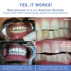 Crystal Clear Teeth Whitening Gel REFILL(10 Pack).made in USA.  Free Shipping!