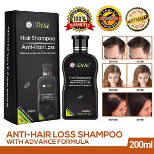 Dexe Original Anti Hair Loss Shampoo Natural Herbal Hair Growth Treatment 200ml