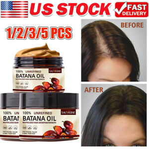 Batana Oil - Hair Growth Cream - Prevents Hair Loss, Repair Damaged Hair Care
