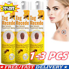 Tag Recede Bee Venom Treatment Spray, Tag Recede, Bee Venom Spray, for All Skin