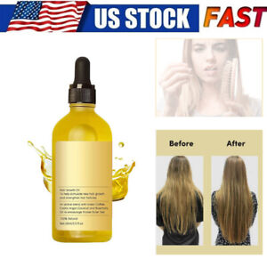 New Natural Hair Growth Oil, Veganic Natural Hair Growth Oil 60ml