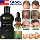 DEXE 200ml Anti-Hair Loss Shampoo Promote Hair Growth Shampoo for Men & Women