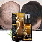 1~3x Biotin Hair Growth Spray Anti Hair Loss Fast Regrowth Scalp Treatment Serum