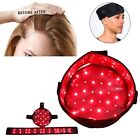 LED Laser Hair Growth Cap Hair Loss Infrared Treatment Regrowth Therapy US CIqSr