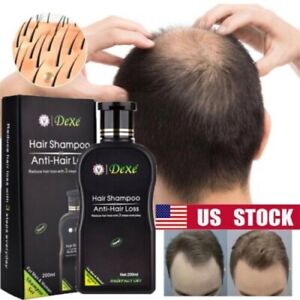 Dexe Hair Shampoo Anti hair Loss Treatment Fast Hair Growth For Men & Women