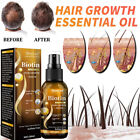 Biotin Hair Growth Spray Anti Hair Loss Fast Regrowth Scalp Treatment Serum US