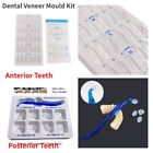 Dental Mould Composite Resin Veneer Anterior Posterior Veneer Molar Restoration