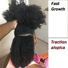 Fast Hair Growth Oil Africa Traction Alopica Serum Promotes Hair Growth 50ml