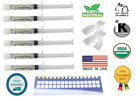 Professional SENSITIVE Teeth Whitening Kit 22% + (6) Syringes + (2) Mouth Trays
