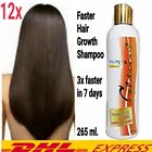12x Genive Long Hair Fast Growth Shampoo Helps Your Hair to Lengthen Grow Longer