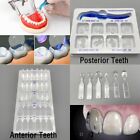 Dental Veneers Mould Composite Resin Anterior Posterior Teeth Molar Restoration