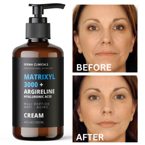 Matrixyl 3000, Argireline Hyaluronic Acid Peptide AntiAging serum Wrinkle CREAM