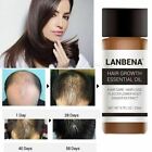 2 Pack Lanbena Natural Hair Loss Treatment Fast Hair Growth Essential Oil 20ml