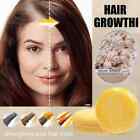 2×Ginger Hair Growth Shampoo Bar Soap hair Regrowth Anti Hair Loss damage repair