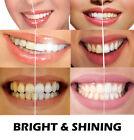 ADVANCED Teeth Whitening UV LED Kit - 44% CP Peroxide Gel - Instant Whitening