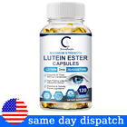 Eye Health Supplement, Lutein and Zeaxanthin, Vision Health, Eye Strain Support