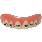 Instant Smile Fake Teeth with Braces Costume Accessories