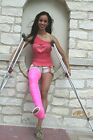 Long Leg Cast Kit | Fiberglass Orthopedic Casting Material | Broken Leg Cast