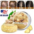 3PCS Ginger Hair Regrowth Shampoo Bar Hair Growth Soap Hair Loss Treatment USA