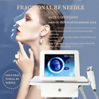 Morpheus8 Fractional Micron-ee-dle Machine Remove Stretch Mark Acne Scar 1Handle