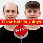 Triple Roll-On Intensive Scalp Serum: Fast Hair Growth Hair Growth Serum