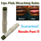 Lips Pink Fresh Fast Lightening Bleaching Cream Balm Treatment Remove Dark New