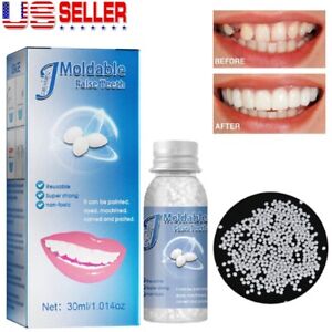 Resin False Teeth Solid Glue Temporary Tooth Repair Moldable Teeth Gap Filler US