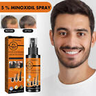 5 % Minoxidil Hair Growth Spray For Men Women 100ml Hair Regrowth Treatment
