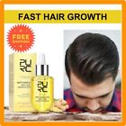 Fast Hair Growth Oil Serum Men Women 50ml | Scalp Treatment, Regrowth, Thicken
