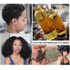 Fast Hair Growth Oil Africa Traction Alopica Serum Promotes Crazy Hair Growth