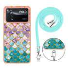 For XiaoMi Poco X4 Pro, Fashion Marble Plating Soft Frame Case Cover + Necklace