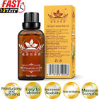 30ml Body Massage Oil Lymphatic Drainage Ginger Oil Beauty Skin Care~