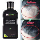 New ListingHair Growth Shampoo Hair Regrowth Treatment Anti-Hair Loss Shampoo For Men Women