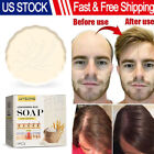 Rice Shampoo Soap Bar Moisturizing Anti-Hair Loss Fast Hair Growth For Women Men