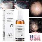 Blusoms Anti-Shedding Hair Spray,Anti Hair Loss Serum Fast Hair Growth Spray US