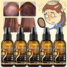 5x Biotin Hair Growth Spray Anti Hair Loss Fast Regrowth Scalp Treatment Serum