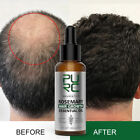 PURC Rosemary Hair Growth Essential Oil - Fully Organic For Women & Men