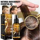 Biotin Hair Growth Spray Anti Hair Loss Fast Regrowth Scalp Treatment Serum