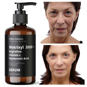 Matrixyl 3000, Argireline Vitamin C Hyaluronic Acid Peptide Wrinkle  SERUM - 8oz