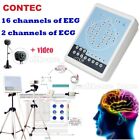 EEG Digital EEG de 16 canales y sistema de mapeo, cerebro eléctrico, vídeo