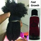 Fast Hair Growth Oil African Traction Onion Serum Promotes Hair Growth 50ML