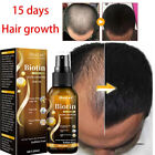 Biotin Hair Growth Spray Anti Hair Loss Fast Regrowth Scalp Treatment Serum US