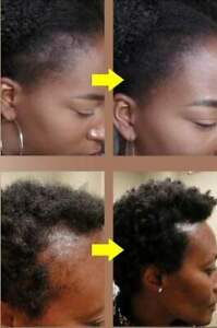 AAA Hair Repair Super Growth Therapy Serum 4 oz