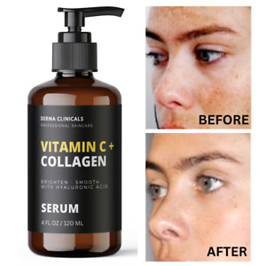 Vitamin C serum + Collagen, Skin Brightening, Anti aging, Wrinkles SERUM - 4oz