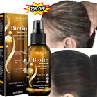New ListingBiotin Hair Growth Spray Anti Hair Loss Fast Regrowth Scalp Treatment Serum US