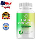 Minch Hair Fast Growth Herbal Pills Prevent Anti Loss Stimulate Fuller thicker