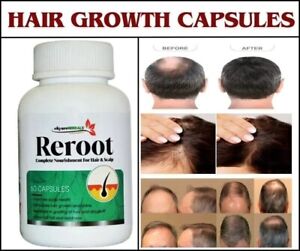 Hair Growth Vitamins For Men - Anti Hair Loss Pills. Regrow Hair & Beard.60caps
