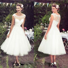 Vintage Lace Applique A-line Wedding Dresses Tea-Length Bridal Gown Custom Size