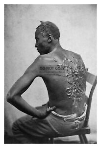 AFRICAN AMERICAN SLAVE ENSLAVED MANS SCARRED BACK 1863 4X6 PHOTO