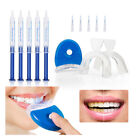 Professional Teeth Whitening Kit Tooth Whitener Gel Bleach White Dental System
